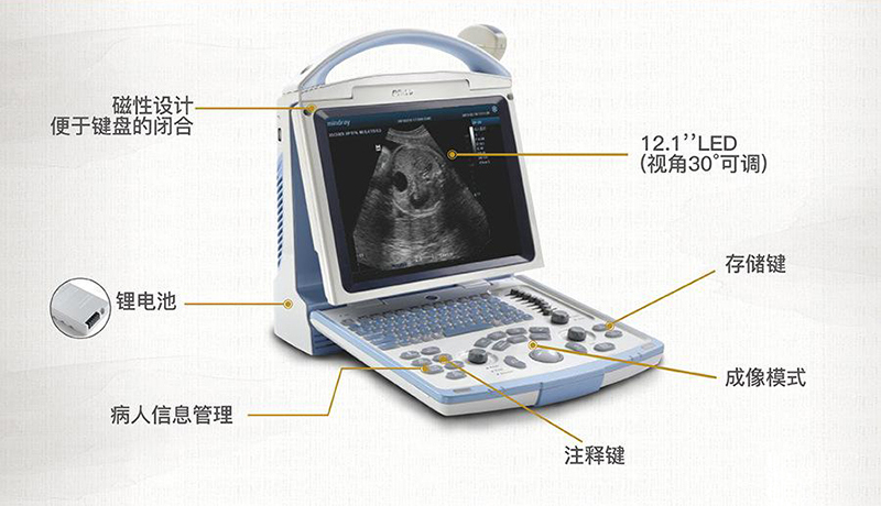 B超机的基本构件包括发射、扫查、接收、信号处理和显示等五个主要组成部分,分别分为两大部件,即主机和探头。 B超机的基本构件包括发射、扫查、接收、信号处理和显示等五个主要组成部分,分别分为两大部件,即主机和探头。